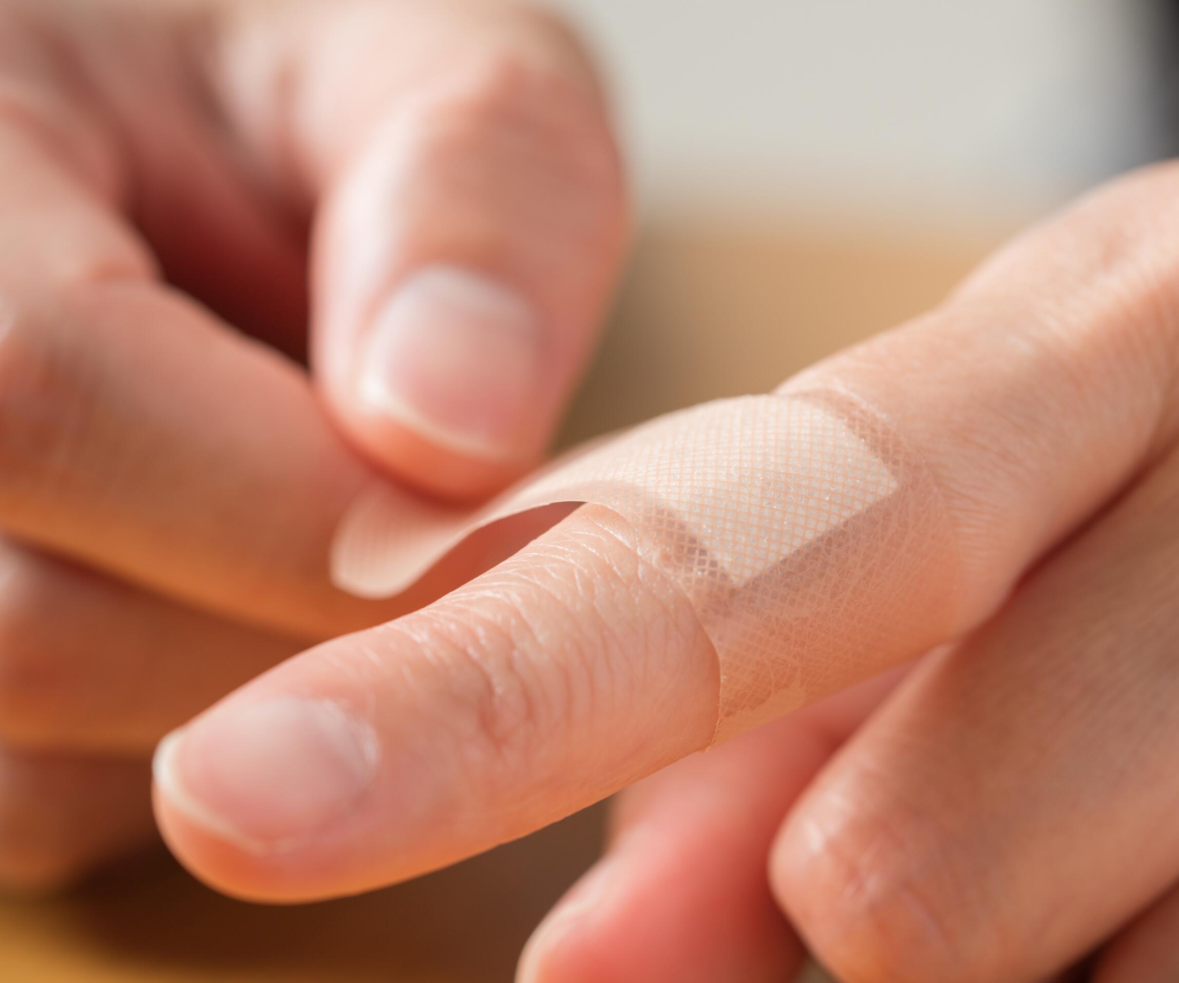 κοινές παρανοήσεις σχετικά με την επούλωση πληγών